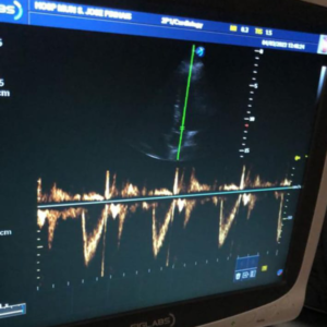 ultrassonografia_emergencias_clinicas_sjpocus_01