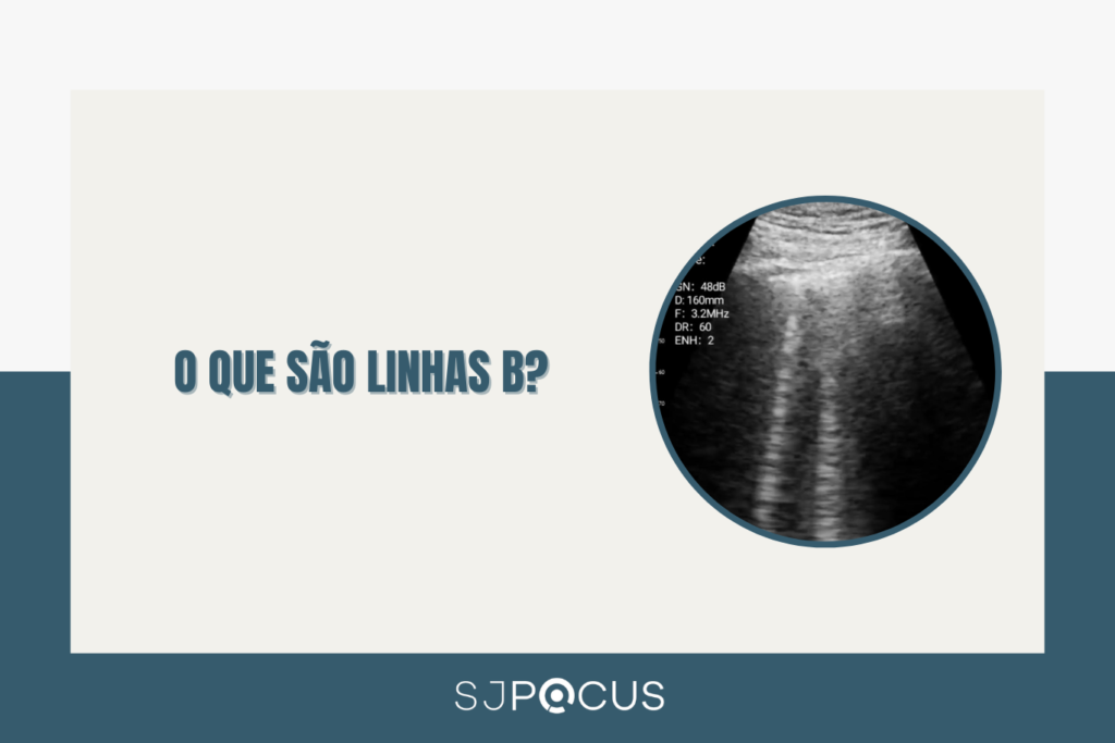 LINHAS B SJPOCUS