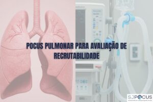 POCUS PULMONAR PARA AVALIAÇÃO DE RECRUTABILIDADE