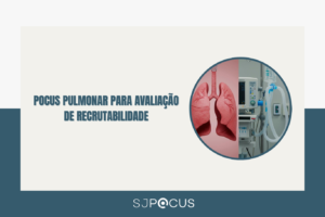 Pocus Pulmonar para Avaliação de Recrutabilidade SJPOCUS