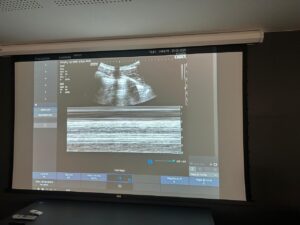 POCUS AVANÇADO SJPOCUS