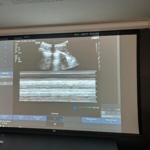 POCUS AVANÇADO SJPOCUS