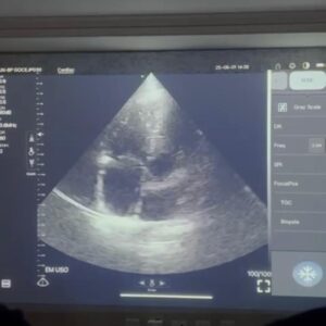 Pocus Emergência Ultrassom Sjpocus